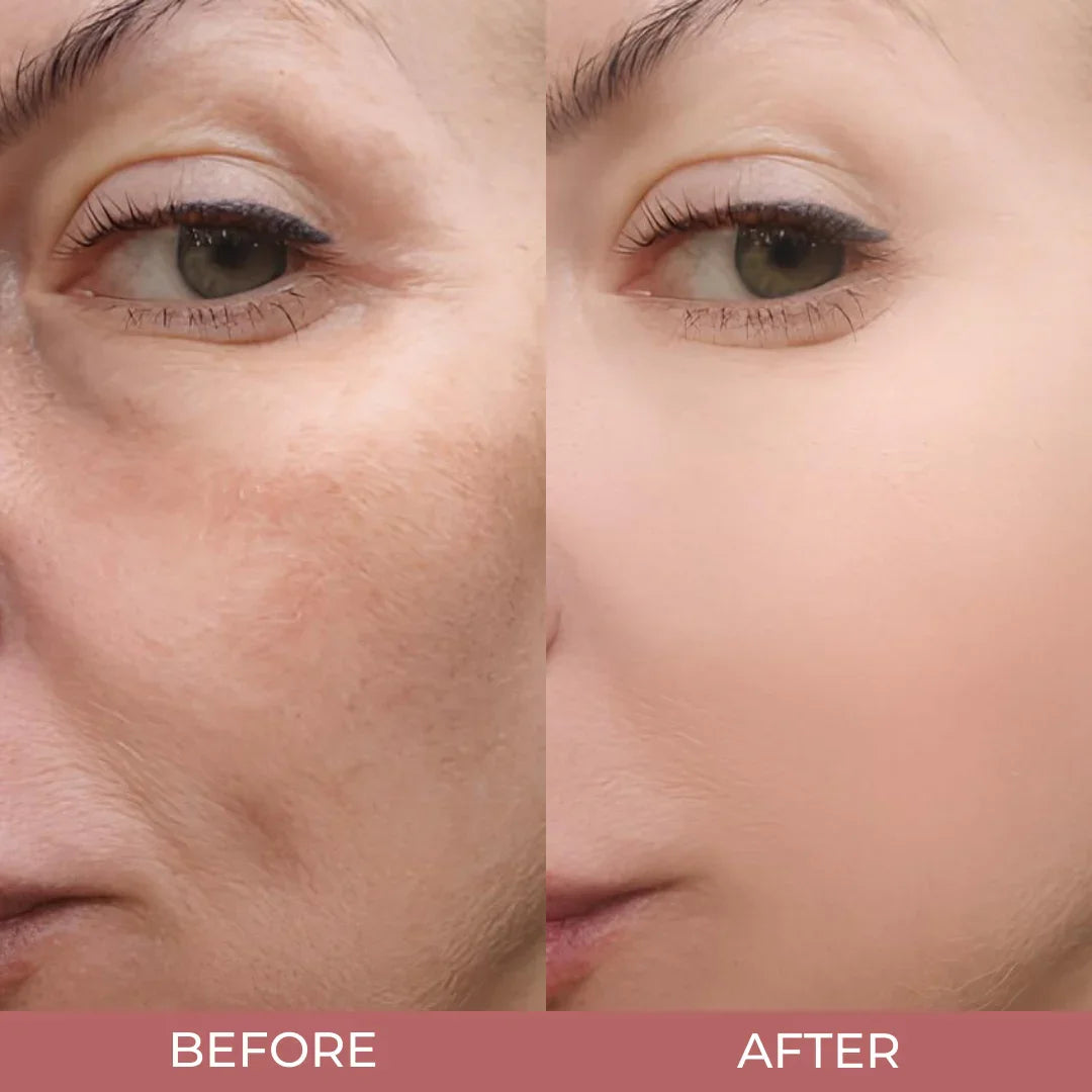 PureMelaxin® - Peel Shot Glow Rice Bundle